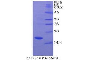 Image no. 1 for Superoxide Dismutase 1, Soluble (SOD1) (AA 2-152) protein (His tag) (ABIN1080855)