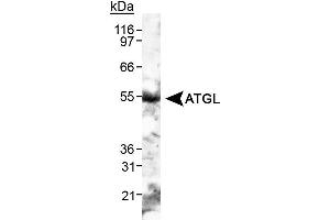 PNPLA2 antibody  (C-Term)