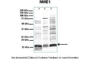 Image no. 1 for anti-Non-Metastatic Cells 1, Protein (NM23A) Expressed in (NME1) (N-Term) antibody (ABIN2792090)