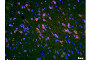 Image no. 2 for anti-Peripheral Myelin Protein 2 (PMP2) (AA 31-132) antibody (ABIN676823)