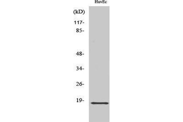 anti-Zinc Finger, HIT-Type Containing 1 (ZNHIT1) (Internal Region) antibody