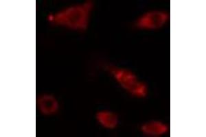 Image no. 1 for anti-DNA Polymerase alpha (POLA1) (N-Term) antibody (ABIN6258119)