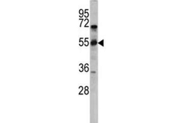 anti-CD36 (CD36) (AA 213-242) antibody
