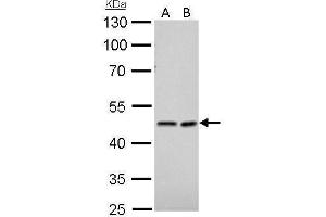 WB Image NDRG1 antibody detects NDRG1 protein by Western blot analysis.