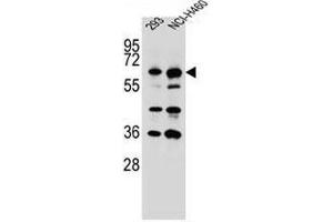 Image no. 2 for anti-Cytoskeleton-Associated Protein 4 (CKAP4) (AA 581-602), (C-Term) antibody (ABIN951537)