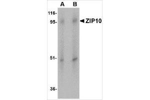 Image no. 2 for anti-Solute Carrier Family 39 (Zinc Transporter), Member 10 (SLC39A10) (Center) antibody (ABIN783820)