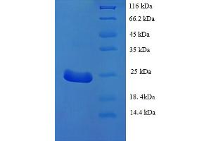Image no. 1 for Lymphocyte Antigen 75 (LY75) (AA 28-211), (partial) protein (His tag) (ABIN5709885)