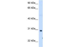 Image no. 1 for anti-ST3 beta-Galactoside alpha-2,3-Sialyltransferase 3 (ST3GAL3) (C-Term) antibody (ABIN630406)