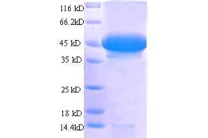 Image no. 1 for Stanniocalcin 1 (STC1) (AA 39-247), (partial) protein (GST tag) (ABIN5712710)