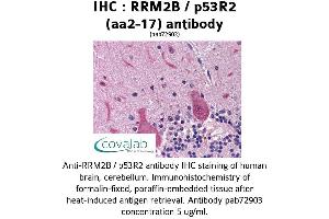 Image no. 2 for anti-Ribonucleotide Reductase M2 B (TP53 Inducible) (RRM2B) (AA 2-17) antibody (ABIN1738967)