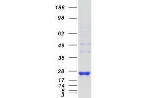 Image no. 1 for RAB8B, Member RAS Oncogene Family (RAB8B) protein (Myc-DYKDDDDK Tag) (ABIN2730374)