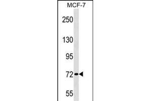 ZN Antibody (Center) (ABIN1538115 and ABIN2848690) western blot analysis in MCF-7 cell line lysates (35 μg/lane).