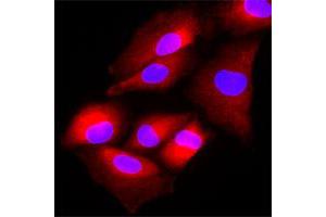 Image no. 1 for anti-N-Acetyltransferase 6 (GCN5-Related) (NAT6) antibody (ABIN5584205)