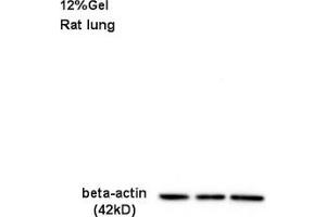Image no. 2 for anti-Actin, beta (ACTB) (AA 1-50) antibody (ABIN724340)