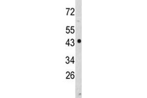 Image no. 1 for anti-N-Myc Downstream Regulated 1 (NDRG1) (AA 12-40) antibody (ABIN3028862)