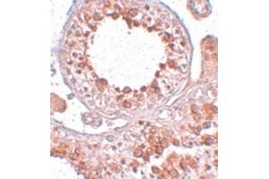 Image no. 2 for anti-ESX Homeobox 1 (ESX1) (Internal Region) antibody (ABIN6655411)