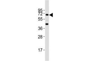 Image no. 3 for anti-Transforming Growth Factor, beta Receptor II (70/80kDa) (TGFBR2) (AA 13-40) antibody (ABIN3029224)