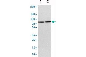 Image no. 3 for anti-TBC1 Domain Family, Member 15 (TBC1D15) antibody (ABIN5589225)