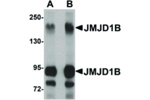 Image no. 1 for anti-Lysine (K)-Specific Demethylase 3B (KDM3B) (Internal Region) antibody (ABIN6657025)