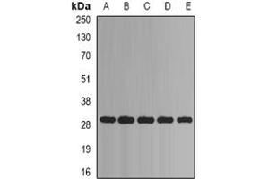 Image no. 2 for anti-Proteasome Subunit alpha Type 1 (PSMA1) (full length) antibody (ABIN6005028)