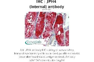 Image no. 1 for anti-Junctophilin 4 (JPH4) (Internal Region) antibody (ABIN1736134)
