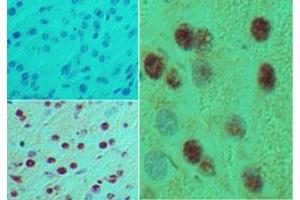 Image no. 1 for anti-Motor Neuron and Pancreas Homeobox 1 (MNX1) (AA 330-380) antibody (ABIN960266)