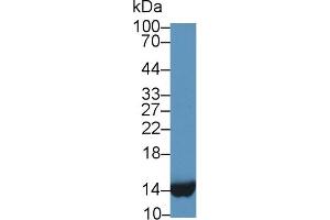 Image no. 3 for Fatty Acid Binding Protein 1, Liver (FABP1) ELISA Kit (ABIN6720499)