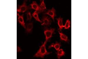 Image no. 3 for anti-Drought-Repressed 4 Protein (DR4) antibody (ABIN6265699)