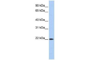 Image no. 1 for anti-Deoxyribonuclease II beta (DNASE2B) (Middle Region) antibody (ABIN633853)