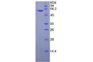 Image no. 1 for Thrombospondin 4 (THBS4) protein (ABIN3011851)