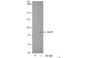 Image no. 9 for anti-Heat Shock 70kDa Protein 5 (Glucose-Regulated Protein, 78kDa) (HSPA5) (Internal Region) antibody (ABIN2855429)
