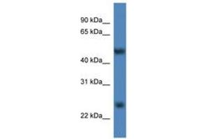 Image no. 1 for anti-Methyltransferase Like 4 (METTL4) (AA 361-410) antibody (ABIN6746295)