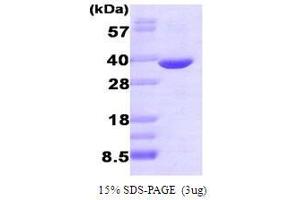 Aldo-Keto Reductase Family 1, Member B1 (Aldose Reductase) (AKR1B1) (AA 1-316) (Active) protein
