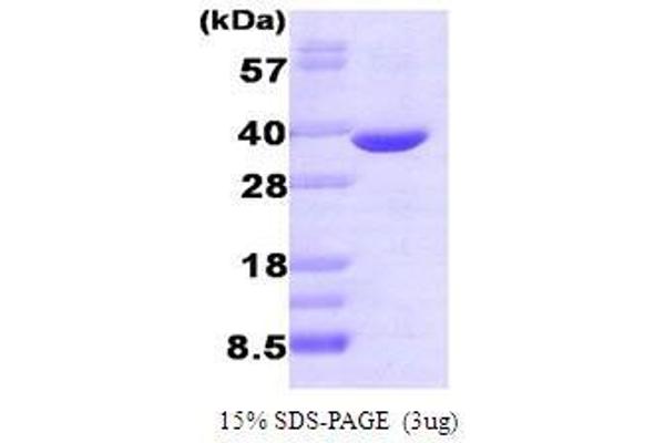 Aldo-Keto Reductase Family 1, Member B1 (Aldose Reductase) (AKR1B1) (AA 1-316) (Active) protein