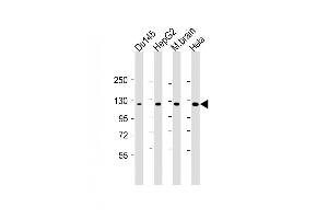 Image no. 1 for anti-DAB2 Interacting Protein (DAB2IP) antibody (ABIN4908550)