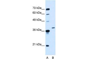 Image no. 1 for anti-Homeobox D11 (HOXD11) (Middle Region) antibody (ABIN2777523)