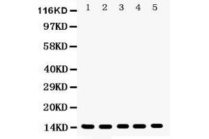Image no. 1 for anti-Profilin 1 (PFN1) (AA 116-140), (C-Term) antibody (ABIN3043603)