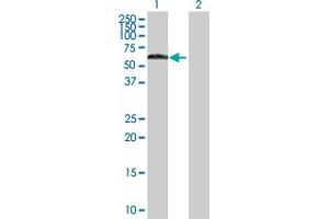 Image no. 1 for anti-Synovial Sarcoma Translocation, Chromosome 18 (SS18) (AA 1-418) antibody (ABIN520525)