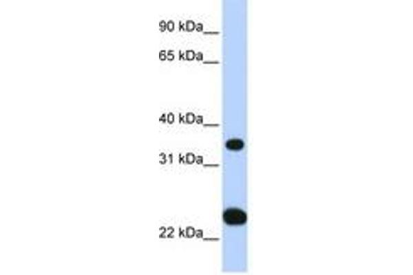 SLC25A35 Antikörper  (N-Term)