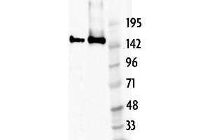 Image no. 2 for anti-CRISPR-Cas9 (N-Term) antibody (ABIN6971494)