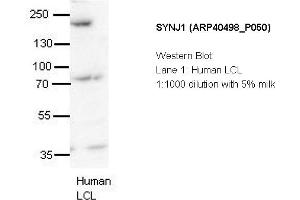Image no. 2 for anti-Synaptojanin 1 (SYNJ1) (N-Term) antibody (ABIN2778875)