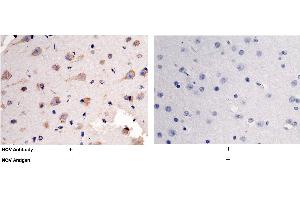 Image no. 2 for anti-Nephroblastoma Overexpressed (NOV) (AA 1-357) antibody (ABIN1996223)