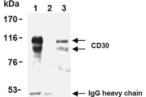 Image no. 2 for anti-Tumor Necrosis Factor Receptor Superfamily, Member 8 (TNFRSF8) antibody (ABIN492585)