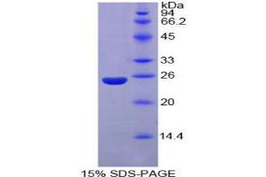 NUP160 Protein