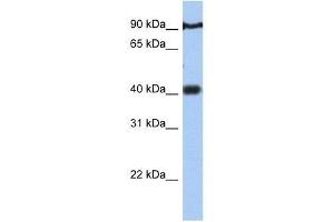 Image no. 1 for anti-Prostate Tumor Overexpressed 1 (PTOV1) (N-Term) antibody (ABIN928403)