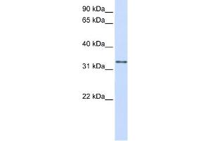 Image no. 1 for anti-Trans-2,3-Enoyl-CoA Reductase (TECR) (C-Term) antibody (ABIN2783369)