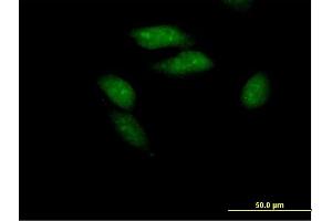 Image no. 2 for anti-Polycomb Group Ring Finger 3 (PCGF3) (AA 1-242) antibody (ABIN523741)