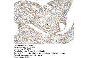 Image no. 2 for anti-Creatine Kinase, Mitochondrial 2 (Sarcomeric) (CKMT2) (N-Term) antibody (ABIN2776839)