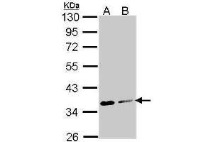 Image no. 4 for anti-Aspartoacylase (ASPA) (Center) antibody (ABIN2856897)