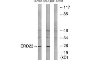 Image no. 2 for anti-KDEL (Lys-Asp-Glu-Leu) Endoplasmic Reticulum Protein Retention Receptor 2 (KDELR2) (AA 81-130) antibody (ABIN1534894)